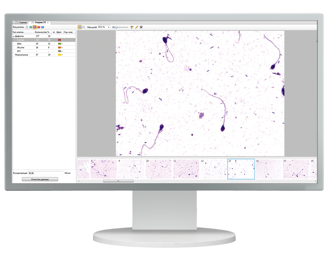 The full picture in Sperm Analysis<br> SQA-iO and Vision Sperm